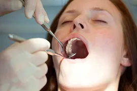 Woman receiving a teeth cleaning