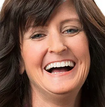 after dental implants